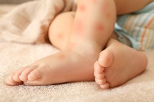 寝るときの蚊対策3選！部屋に蚊が入ったときの対処法を紹介